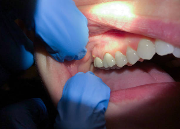 Best Pediatric Emergency Dentist in Lutherville, MD